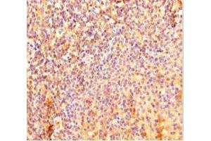 Immunohistochemistry of paraffin-embedded human tonsil tissue using ABIN7157778 at dilution of 1:100 (IL4I1 antibody  (AA 139-339))