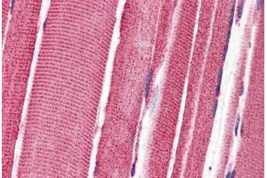 Human Skeletal Muscle (formalin-fixed, paraffin-embedded) stained with FEZ2 antibody ABIN343909 at 3 ug/ml followed by biotinylated goat anti-rabbit IgG secondary antibody ABIN481713, alkaline phosphatase-streptavidin and chromogen. (FEZ2 antibody  (C-Term))