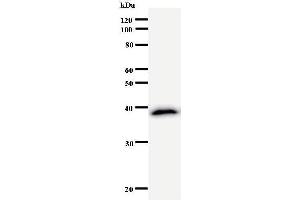 Western Blotting (WB) image for anti-CSRP2 Binding Protein (CSRP2BP) antibody (ABIN931052) (CSRP2BP antibody)