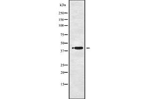 Western blot analysis of P2RY1 using COLO205 whole cell lysates (P2RY1 antibody  (C-Term))