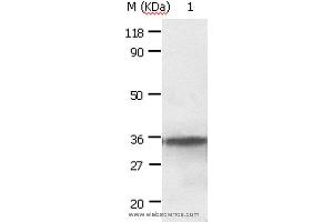 Western blot analysis of HepG2 cell, using ANXA2 Polyclonal Antibody at dilution of 1:640 (Annexin A2 antibody)