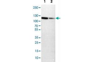 Western Blot analysis of Lane 1: NIH-3T3 cell lysate (mouse embryonic fibroblast cells) and Lane 2: NBT-II cell lysate (Wistar rat bladder tumor cells) with MCM3 polyclonal antibody . (MCM3 antibody)