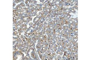 IHC analysis of ACE using anti-ACE antibody (ABIN3043777). (Angiotensin I Converting Enzyme 1 antibody  (AA 651-864))
