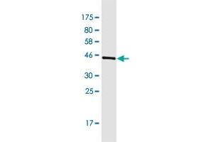 Western Blot detection against Immunogen (44. (BOD1L2 antibody  (AA 1-172))