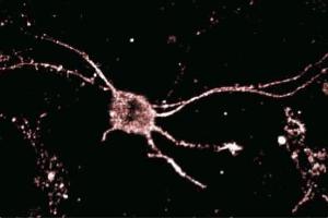 Immunofluorescence staining of rat neurons. (DYNLL1 antibody  (AA 1-89))