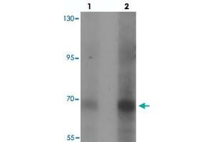 Western blot analysis of CCDC22 in 293 cell lysate with CCDC22 polyclonal antibody  at (lane 1) 1 and (lane 2) 2 ug/mL. (CCDC22 antibody  (N-Term))