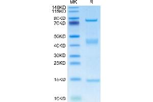 Rat GARP&Latent TGF Beta 1 Complex on Tris-Bis PAGE under reduced condition. (GARP & Latent TGF beta 1 Complex (AA 18-628) protein (His-Avi Tag))