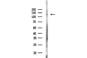 Western blot analysis of lysates from Mouse lung, using Vinculin Antibody at 1/1000 dilution.