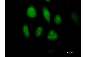Immunofluorescence of purified MaxPab antibody to MLKL on HeLa cell. (MLKL antibody  (AA 1-471))