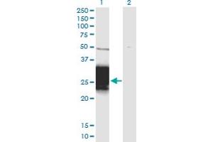 Western Blot analysis of ZNF428 expression in transfected 293T cell line by ZNF428 monoclonal antibody (M01), clone 3H4. (ZNF428 antibody  (AA 1-188))