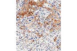 Immunohistochemistry (Paraffin-embedded Sections) (IHC (p)) image for anti-Signal Transducer and Activator of Transcription 1, 91kDa (STAT1) (AA 717-745), (C-Term) antibody (ABIN1881847)