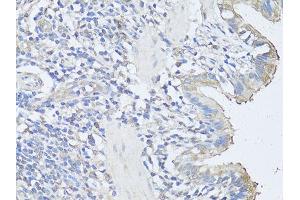 Immunohistochemistry of paraffin-embedded rat lung using CASP3 antibody (ABIN6292881) at dilution of 1:100 (40x lens). (Caspase 3 antibody)