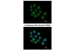 ICC/IF Image Immunofluorescence analysis of paraformaldehyde-fixed A431, using DDX5, antibody at 1:500 dilution. (DDX5 antibody  (C-Term))