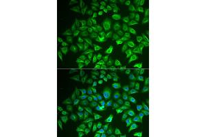 Immunofluorescence analysis of A549 cells using EHHADH antibody (ABIN6292474).
