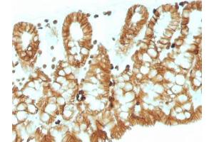 Immunohistochemistry (IHC) image for anti-Epithelial Cell Adhesion Molecule (EPCAM) (Cytoplasmic Domain) antibody (ABIN3024723)