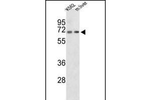 Western blot analysis of CROT Antibody (N-term) (ABIN653328 and ABIN2842818) in K562 cell line and mouse liver tissue lysates (35 μg/lane). (CROT antibody  (N-Term))