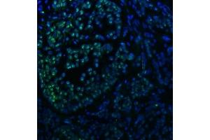 IF analysis of SNRNP40 using anti-SNRNP40 antibody (ABIN7601719).