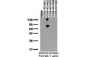Adult rat brain membrane (RBM) and transfected cell immunoblot: extracts of RBM and COS-1 cells transiently transfected with KCNQ1, KCNQ2, KCNQ3, KCNQ4, KCNQ5 or Kv2.