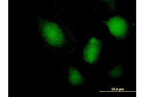 Immunofluorescence of purified MaxPab antibody to NFATC3 on HeLa cell. (NFATC3 antibody  (AA 1-1068))