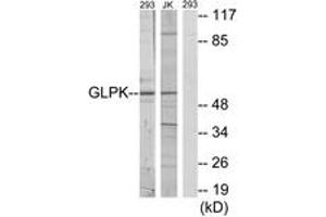 Western blot analysis of extracts from 293/Jurkat cells, using GK Antibody. (Glycerol Kinase antibody  (AA 461-510))