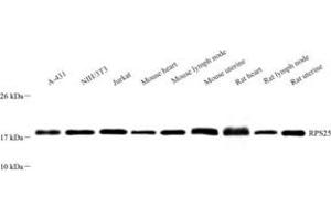 Western blot analysis of RPS25 (ABIN7075449)at dilution of 1: 1000