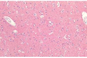 Immunohistochemistry analysis using Rabbit Anti-Tau Polyclonal Antibody (ABIN6698775). (tau antibody  (FITC))