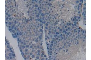 DAB staining on IHC-P; Samples: Mouse Testis Tissue (Caspase 9 antibody  (AA 1-200))