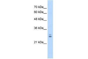 WB Suggested Anti-KCTD11 Antibody Titration:  1. (KCTD11 antibody  (N-Term))