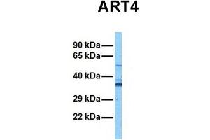 Host:  Rabbit  Target Name:  ART4  Sample Tissue:  Human Stomach Tumor  Antibody Dilution:  1. (ART4 antibody  (Middle Region))