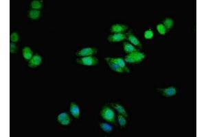 Immunofluorescent analysis of HepG2 cells using ABIN7173051 at dilution of 1:100 and Alexa Fluor 488-congugated AffiniPure Goat Anti-Rabbit IgG(H+L) (TMEM139 antibody  (AA 56-216))