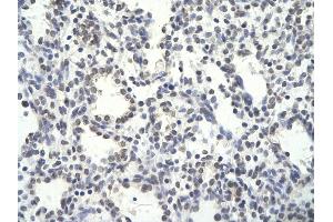Human Lung; . (PSMD14 antibody  (N-Term))