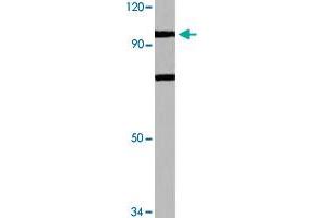 Western blot analysis of HeLa cell lysate with N4BP1 polyclonal antibody  at 1:500 dilution. (N4BP1 antibody)