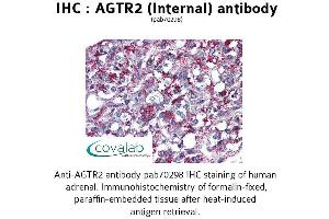 Image no. 1 for anti-Angiotensin II Receptor, Type 2 (AGTR2) (Internal Region) antibody (ABIN1731612) (Angiotensin II Type 2 Receptor antibody  (Internal Region))