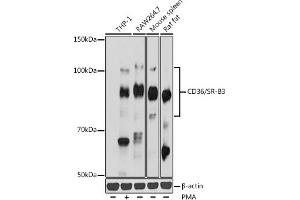 Western blot analysis of extracts of various cell lines, using CD36/SR-B3 antibody (ABIN7266189) at 1:1000 dilution. (CD36 antibody  (AA 301-400))