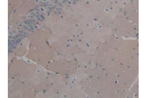 Detection of FGF2 in Mouse Brain Tissue using Polyclonal Antibody to Fibroblast Growth Factor 2, Basic (FGF2) (FGF2 antibody  (AA 10-154))