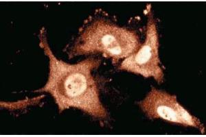 Immunofluorescence staining of human endothelial cells. (TIAL1 antibody  (AA 161-365))