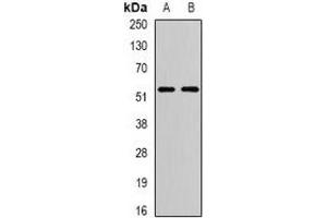 Western blot analysis of ATG13 expression in T47D (A), SW480 (B) whole cell lysates. (ATG13 antibody)