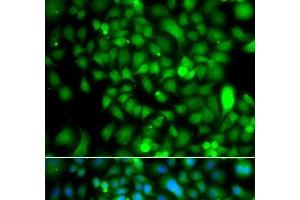 CSRP2BP antibody