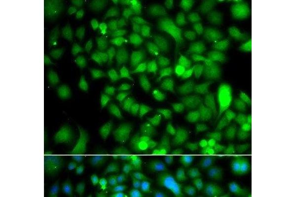 CSRP2BP antibody