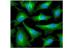 ICC/IF analysis of PRDX6 in HeLa cells line, stained with DAPI (Blue) for nucleus staining and monoclonal anti-human PRDX6 antibody (1:100) with goat anti-mouse IgG-Alexa fluor 488 conjugate (Green). (Peroxiredoxin 6 antibody  (AA 1-224))