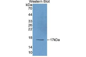 Figure. (EIF2D antibody  (AA 1-117))