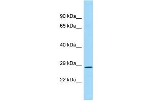 WB Suggested Anti-REP15 Antibody Titration: 1. (REP15 antibody  (N-Term))