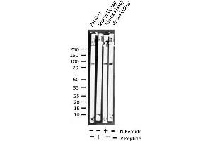 Western blot analysis of Phospho-AhR (Ser36) expression in various lysates (Aryl Hydrocarbon Receptor antibody  (pSer36))