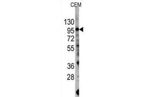 Western blot analysis of anti-PIK3CG Antibody  (R) in CEM cell line lysates (35 μg/lane). (PIK3 gamma antibody  (AA 1079-1102))