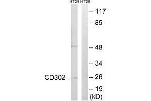 Immunohistochemistry analysis of paraffin-embedded human lymph node tissue using CD302 antibody.