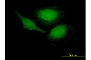 Immunofluorescence of purified MaxPab antibody to PHLDA1 on HeLa cell. (PHLDA1 antibody  (AA 1-259))
