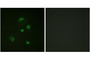 Immunofluorescence analysis of A549 cells, using CHOP (Phospho-Ser30) Antibody. (DDIT3 antibody  (pSer30))