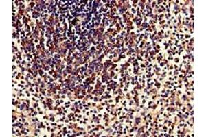 Immunohistochemistry of paraffin-embedded human spleen tissue using ABIN7173913 at dilution of 1:100 (TPD52L2 antibody  (AA 1-206))
