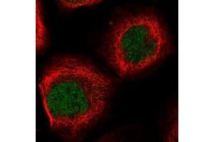 Immunofluorescent staining of human cell line A-431 with EID2 polyclonal antibody  at 1-4 ug/mL dilution shows positivity in nucleus but not nucleoli.