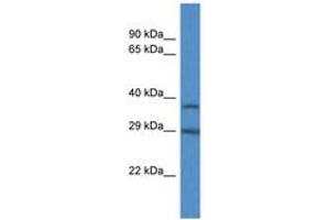 Image no. 1 for anti-RAB34, Member RAS Oncogene Family (RAB34) (C-Term) antibody (ABIN6746857) (RAB34 antibody  (C-Term))